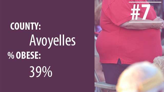 la obeseity7.jpg